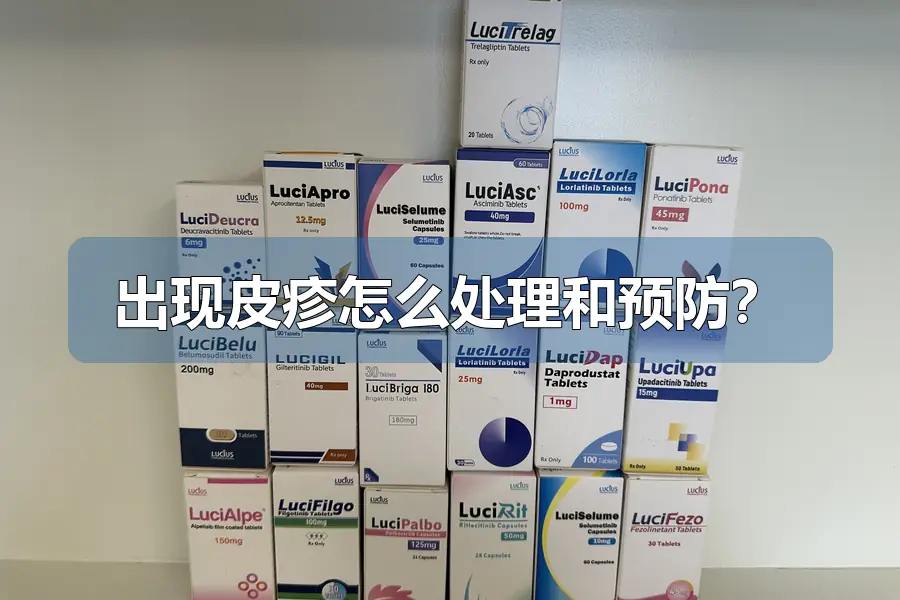 出现皮疹怎么处理和预防?