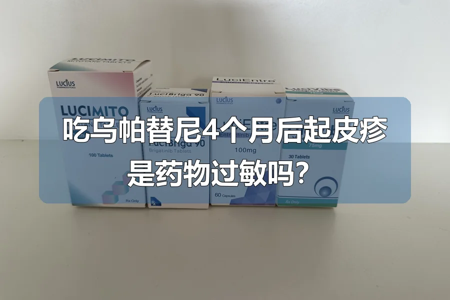 吃乌帕替尼4个月后起皮疹是药物过敏吗?